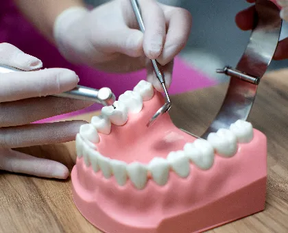 Full Mouth Implant Prosthesis