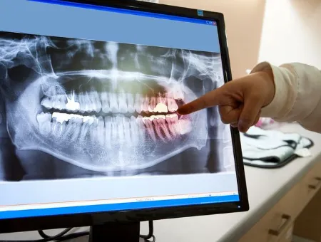 Digital Smile Planning