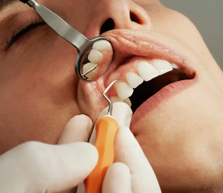 Oral Cancer Screening