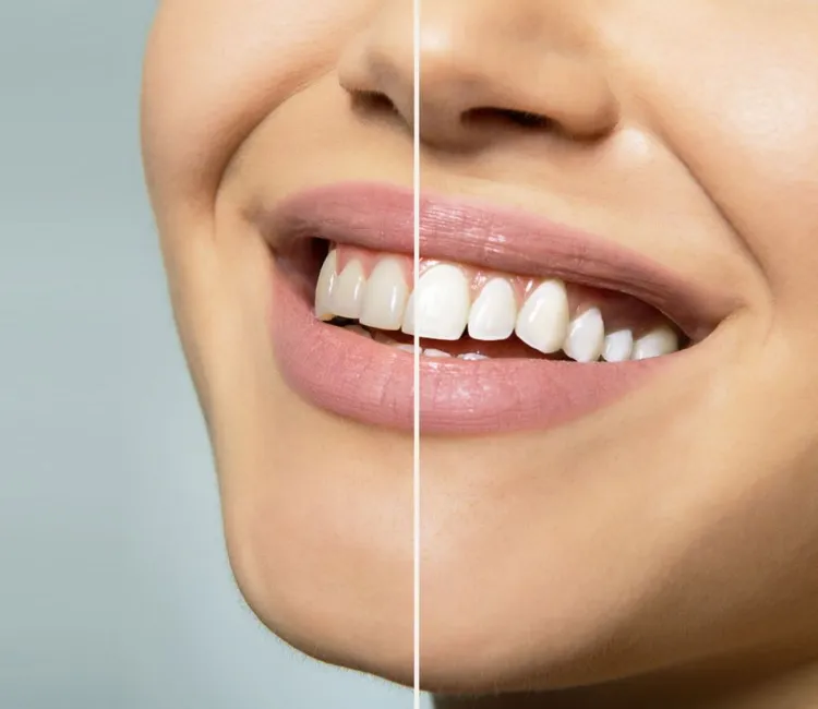 Cosmetic Dentistry
