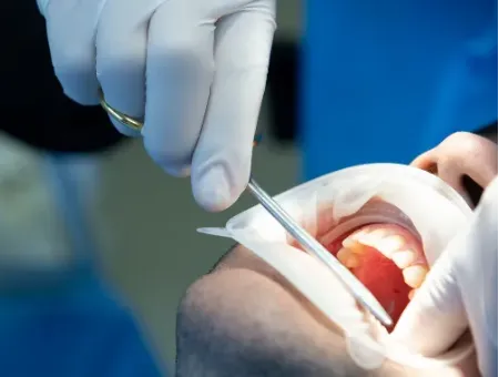 Extra Oral Examination