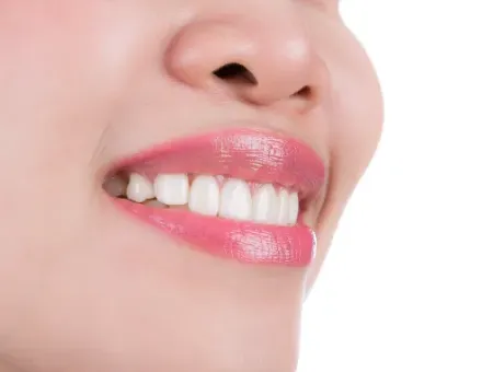 Philips Zoom Whitening