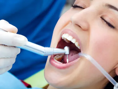 Restorations (Fillings)