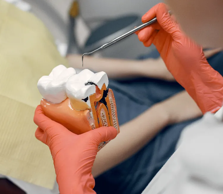 Root Canal Treatment