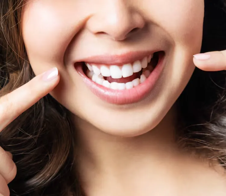 Teeth Whitening